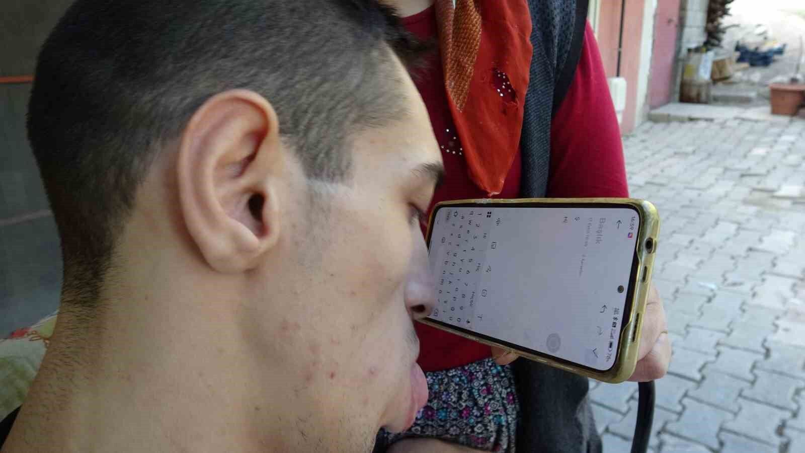 Telefonunu Burnuyla Kullanıyor, Hayatını Kendi Yönetiyor