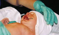 ÇOCUKLARDA SÜNNET İLE İLGİLİ AİLELERİN DİKKAT ETMESİ GEREKENLER