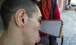 Telefonunu Burnuyla Kullanıyor, Hayatını Kendi Yönetiyor