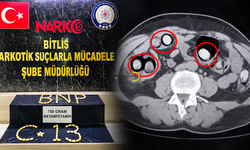 Mide ve bağırsaklarından 758 gram uyuşturucu çıktı
