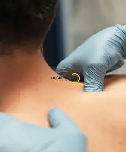 Uzmandan ‘Kulunç’ Uyarısı: Klima ve Stres Ağrıyı Tetikleyebiliyor