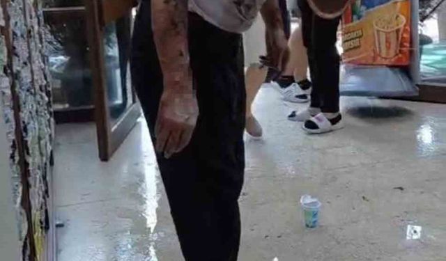 Kostik Patlaması İki Kişiyi Yaraladı