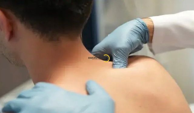 Uzmandan ‘Kulunç’ Uyarısı: Klima ve Stres Ağrıyı Tetikleyebiliyor