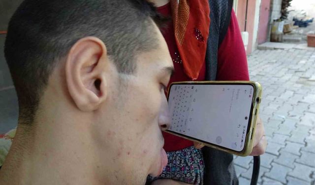 Telefonunu Burnuyla Kullanıyor, Hayatını Kendi Yönetiyor