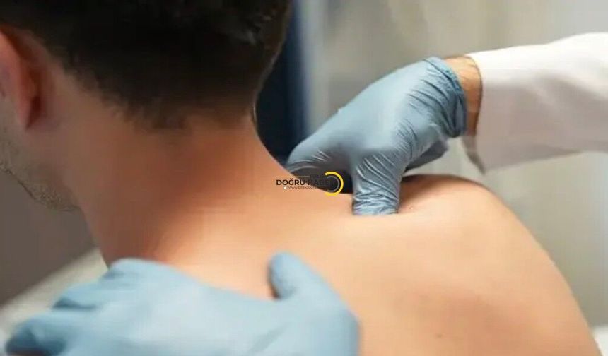 Uzmandan ‘Kulunç’ Uyarısı: Klima ve Stres Ağrıyı Tetikleyebiliyor