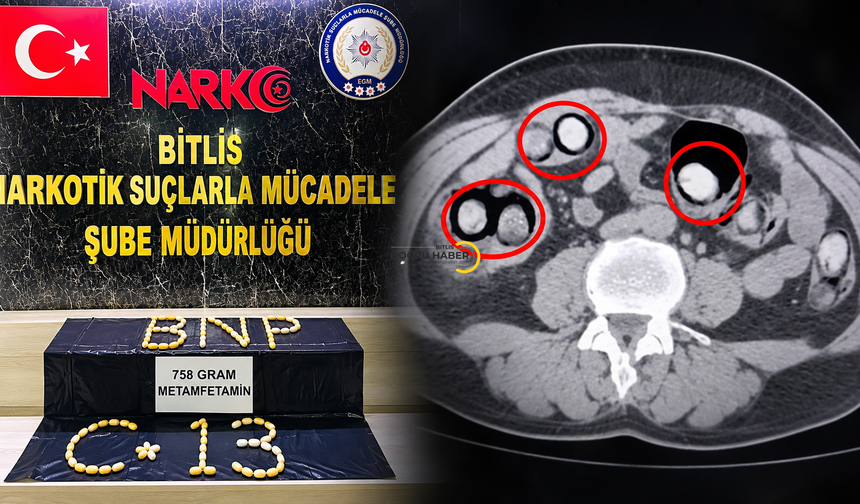 Mide ve bağırsaklarından 758 gram uyuşturucu çıktı
